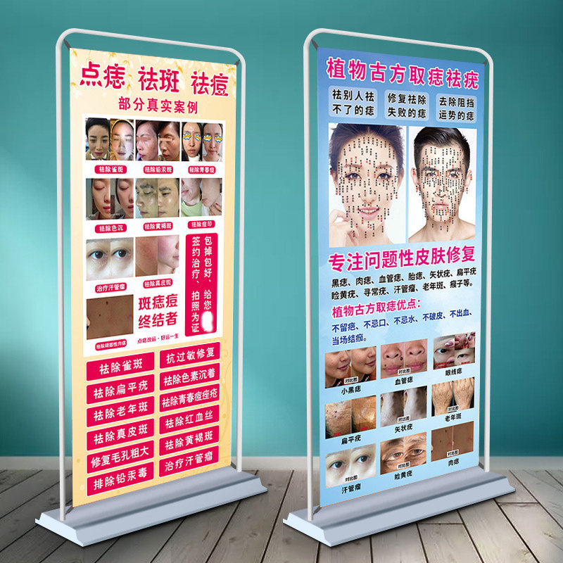 美容院祛斑祛痘取祛痣海报宣传图片展架点痣点疣宣传图广告图面痣