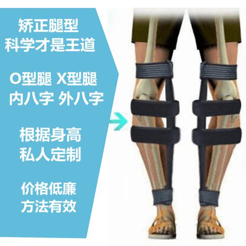 四板式可行走式腿型矫正带适用