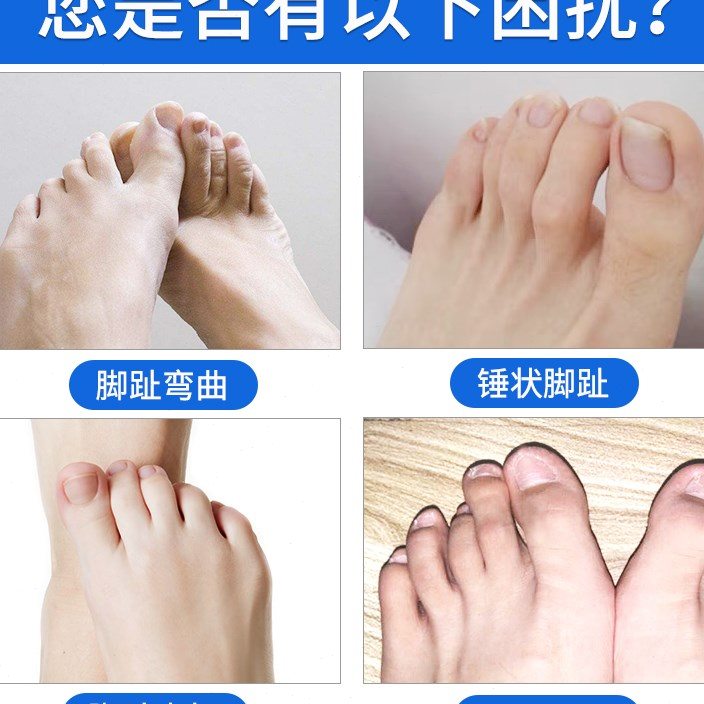 脚趾骨折固定器护脚套可走路小脚趾大脚趾骨折固定夹板矫正护具