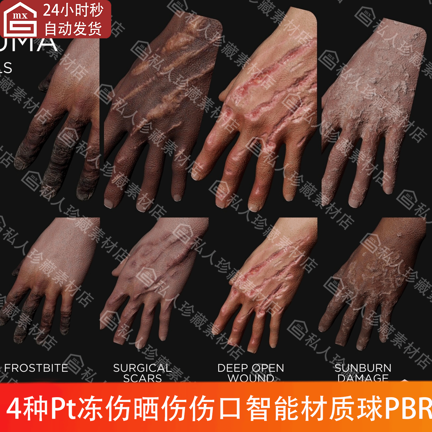 Substance Painter冻伤烧伤晒伤损伤开放伤口疤痕pt智能材质球BPR