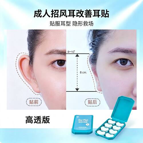 招风耳贴改善高透隐形即用即贴