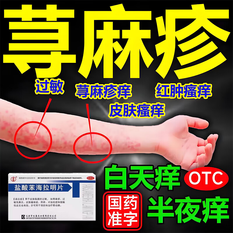 辽生盐酸苯海拉明片24片过敏性鼻炎荨麻疹皮肤瘙痒皮炎晕动症晕车