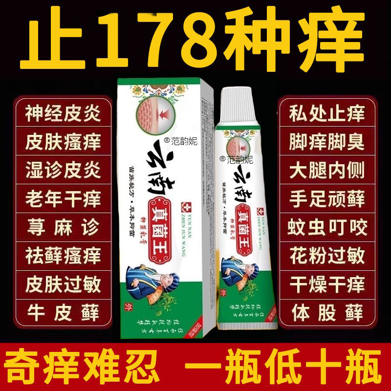 【云南真菌王】正品特效皮肤外用全身皮肤手脚干痒真菌止痒膏杀菌