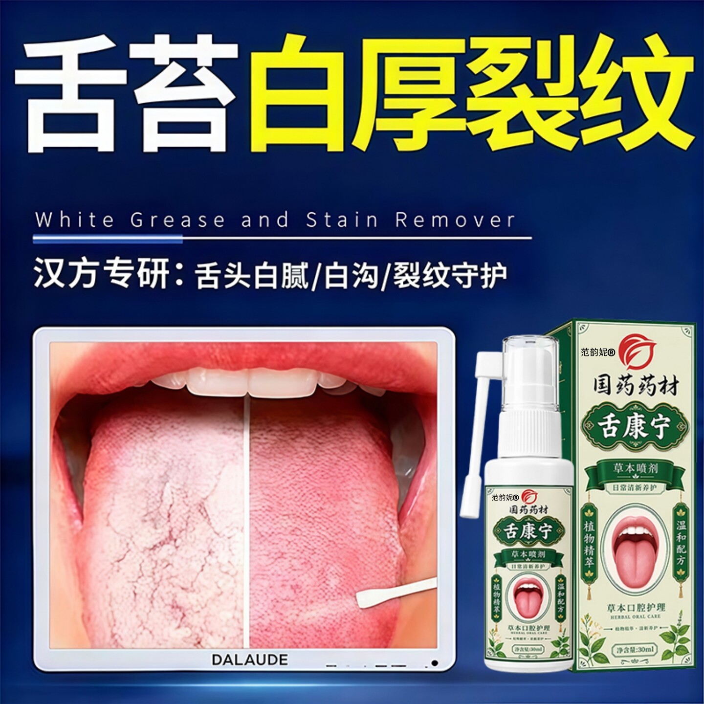 舌康液舌苔白垢分解剂白厚舌头裂纹有齿痕发白厚黄口苦口臭喷雾剂