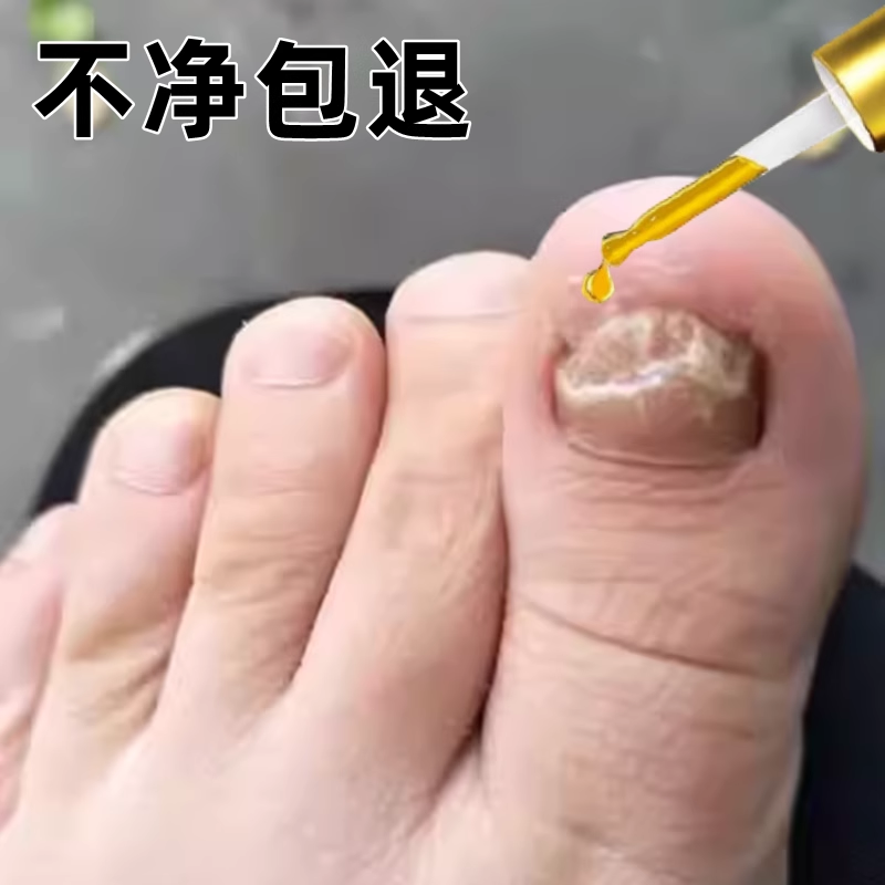 【同仁堂热卖】不脱甲艾草抑菌液