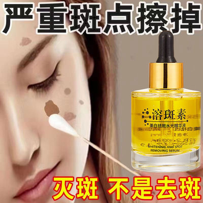 祛斑专用药水丨一擦就掉丨无痛