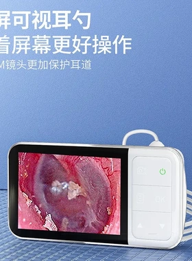 高清可视采耳设备仪器发光一体机