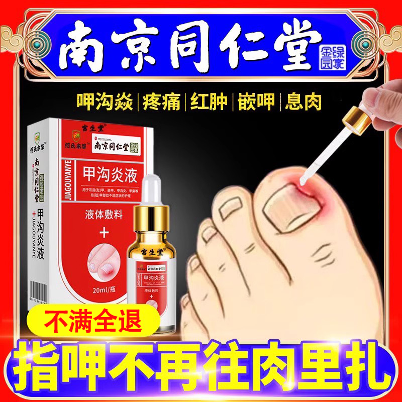 甲沟炎药水药膏消肿软化剂