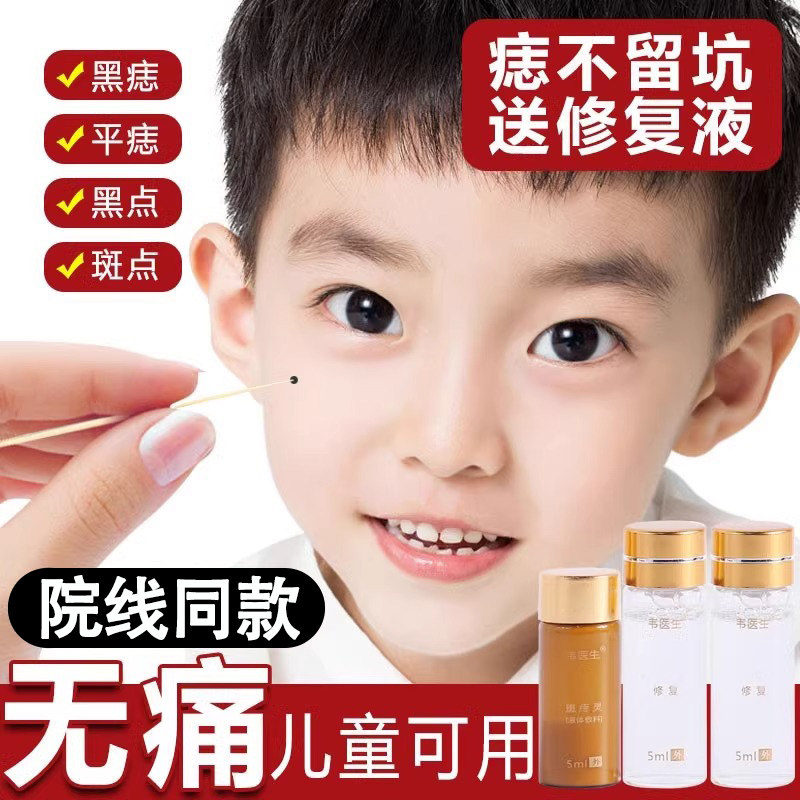 韦医生除痣灵点痣膏无痕正品点痣神器点痣水雀斑专用去痣膏脸部