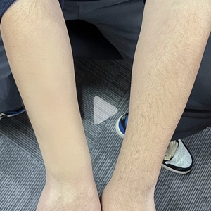 正彩脱毛膏喷雾去毛膏腋下私处腿毛全身慕斯男女生可用
