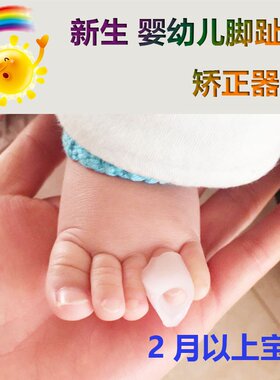 新生儿重叠无名指弯曲脚趾矫正器