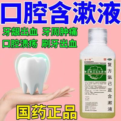 【金口馨】复方氯己定含漱液1.2mg0.2mg*200ml/盒