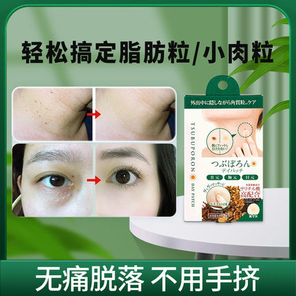 进口美人姬去除眼部脂肪粒脖子小肉粒神器水杨酸隐形贴男女士专用