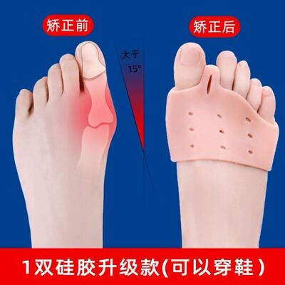 爪形趾矫正器价格 爪形趾矫正器图片 星期三