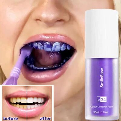 Creme dental n?o invasivo para clareamento de dentes, Respir