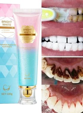 Clareador creme dental nicotinamida deslumbrante creme denta