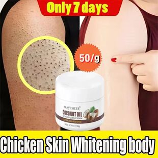 Repair Rem 50g Pilaris Follicle Skin Chicken Keratosis Cream