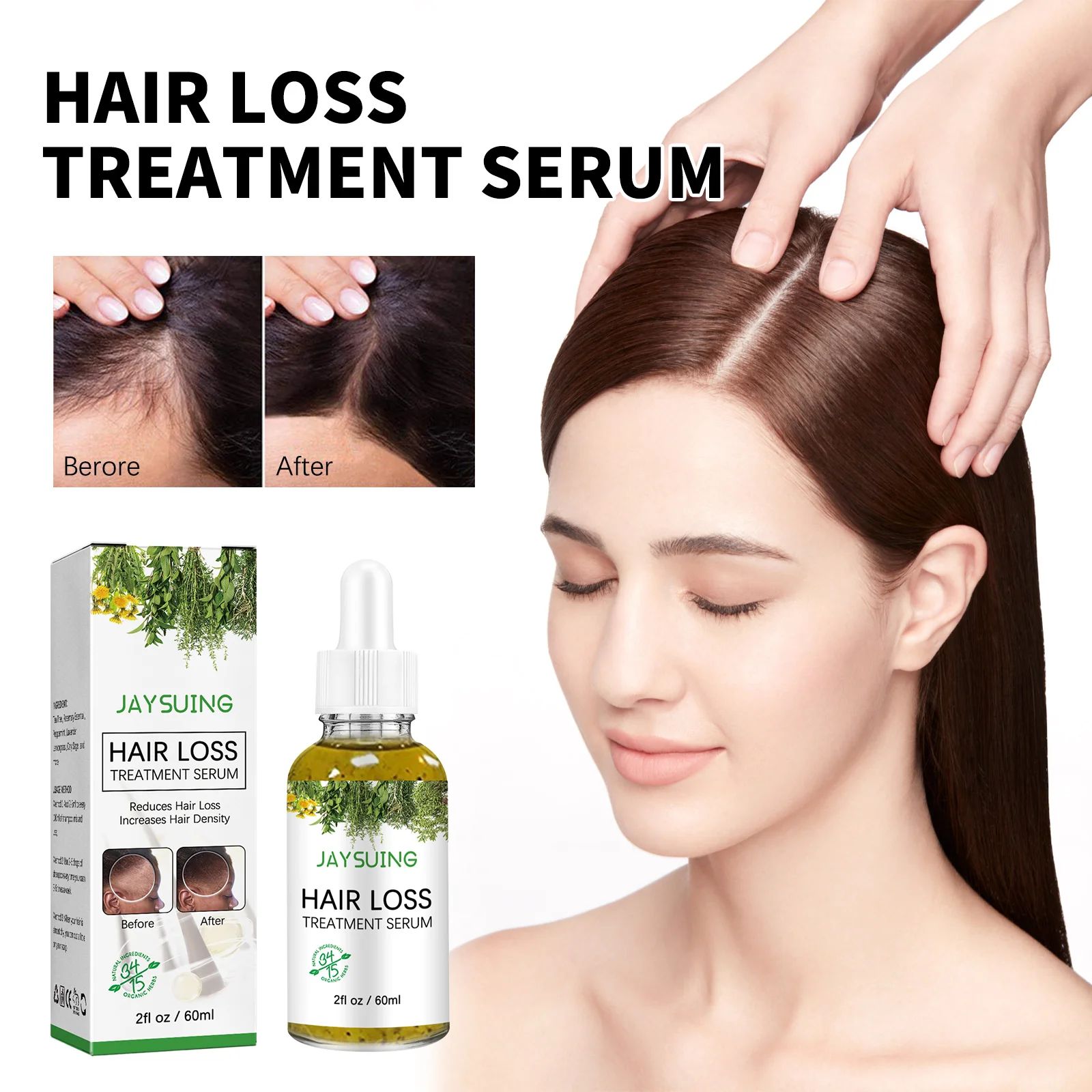 Tratamento de perda de cabelo shampoo anti-coceira anti casp