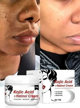 ácido Kójico Facial Brightening Cream, Reduz a melanina, C