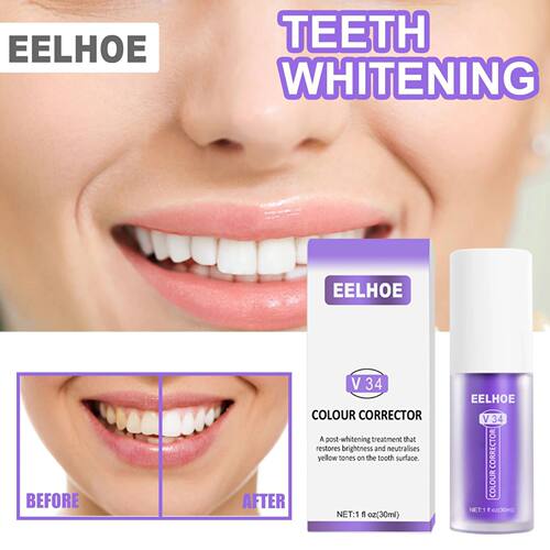 Alta Qualidade Dente Clareamento Colar, Remover Dentes Amare