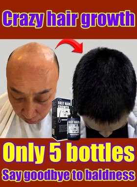 【Venda quente】 Essência de crescimento capilar milagroso,