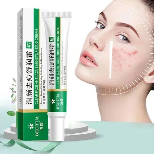 Herbal Acne atment Cream Face Scar Blackhead Remover Repair
