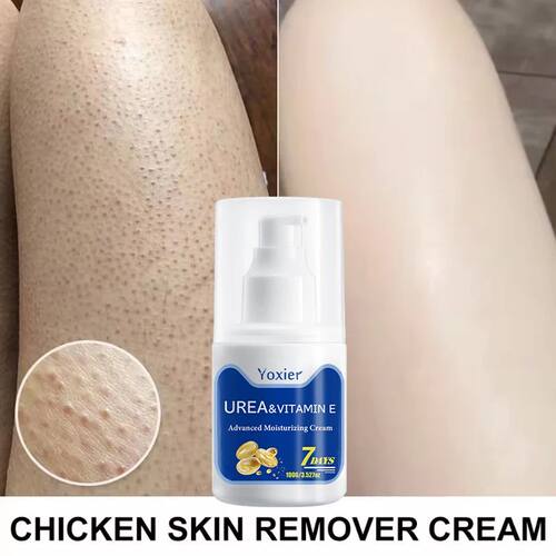 100g Chicken Skin Removal Cream Body Repair Keratosis Pilari