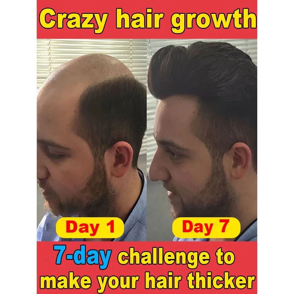 A essência mais poderosa para o crescimento capilar em uma