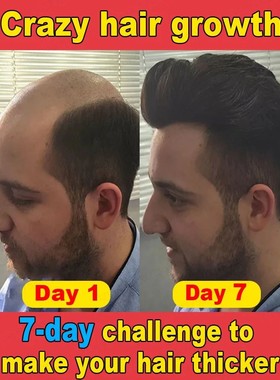 A essência mais poderosa para o crescimento capilar em uma