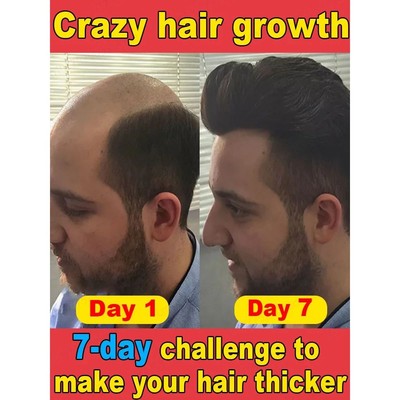 A essência mais poderosa para o crescimento capilar em uma