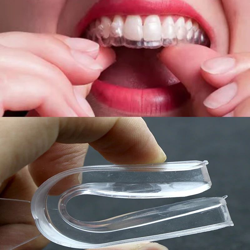 Protector bucal de EVA para blanqueamiento de dientes, bande