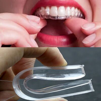 Protector bucal de EVA para blanqueamiento de dientes, bande