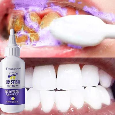 V34 Roxo Creme Dental, Clareamento Dental, Luz Enzimática,