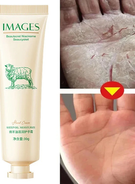 Aceite de oveja chino tradicional, crema hidratante para pie