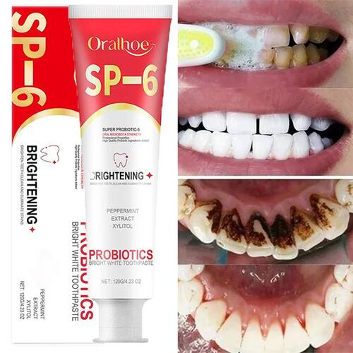 Creme dental probiótico para branquear, SP-6, remove mancha