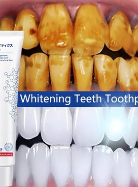 Dentes branqueamento dentífrico Removedor de cálculo denta