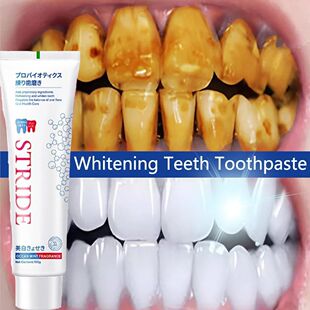 Dentes branqueamento dentífrico Removedor de cálculo denta