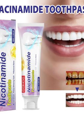 Dentes limpeza e branqueamento creme dental, remove manchas,