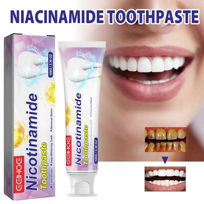 Dentes limpeza e branqueamento creme dental, remove manchas,