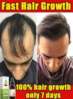 O soro de crescimento capilar mais poderoso que pode fazer o