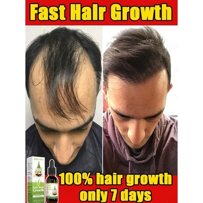 O soro de crescimento capilar mais poderoso que pode fazer o