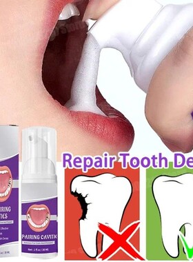 Dentes branqueamento creme dental remo??o de cálculo dental