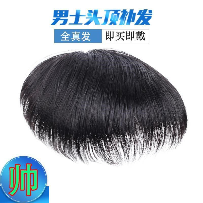 [USD 13.65] Hair loss wig top male hair patch wig set forehead corner ...