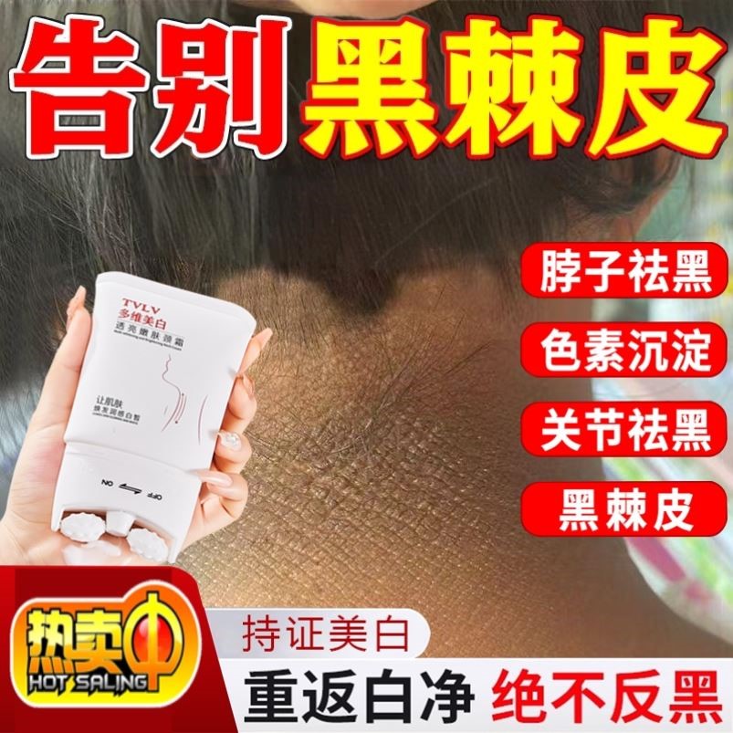 脖子黑色素去除黑棘皮症脖子黑色素沉淀洗不干净肥胖儿童神器