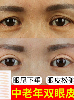 中老年双眼皮贴女隐形自然无痕老年人眼尾防下垂松弛提拉局部定位