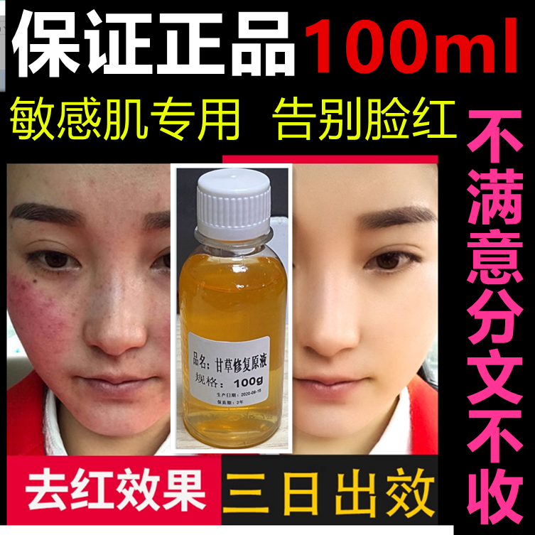 正品甘草精华原液 退红改善敏感肌激素脸祛红血丝止痒增厚角质层
