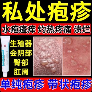 太平阿昔洛韦乳膏20g皮肤性病带状单纯疱疹生殖器疱疹抗病毒抑菌