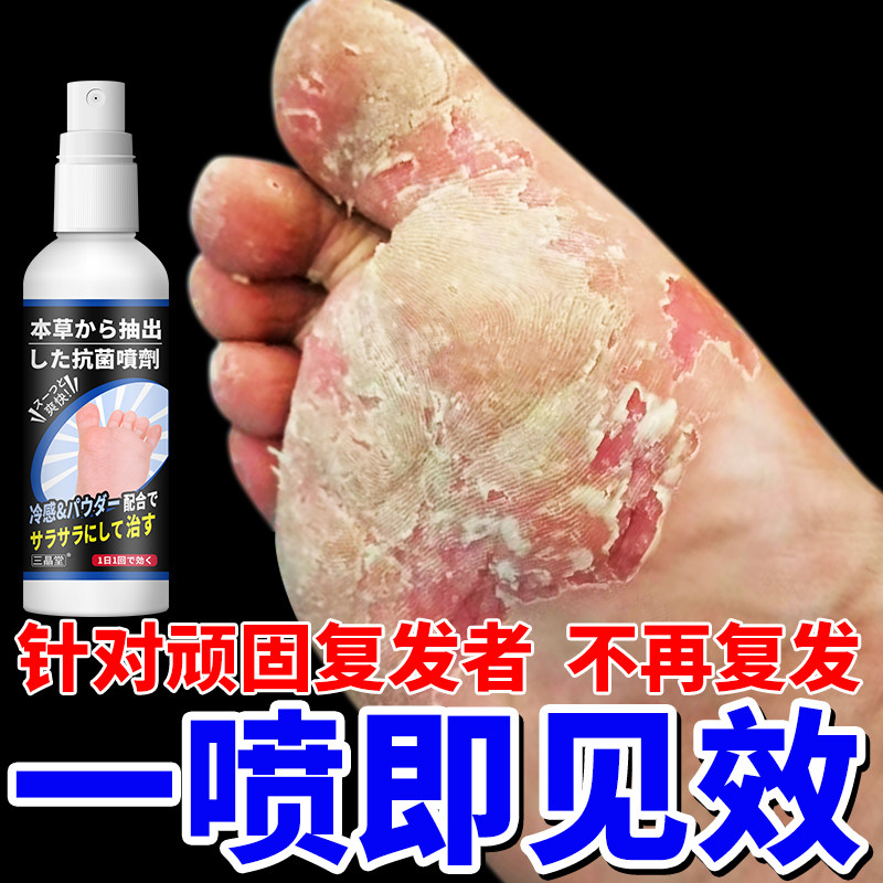 去脚气喷雾烂脚丫除臭止痒药脱皮杀菌膏用水泡脚痒糜烂脚趾缝日本