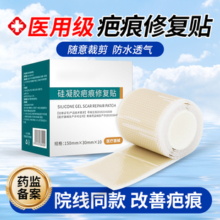 医用疤痕贴刨剖腹产手术硅酮贴抑制增生凸起修复凝胶儿童烫伤摔伤