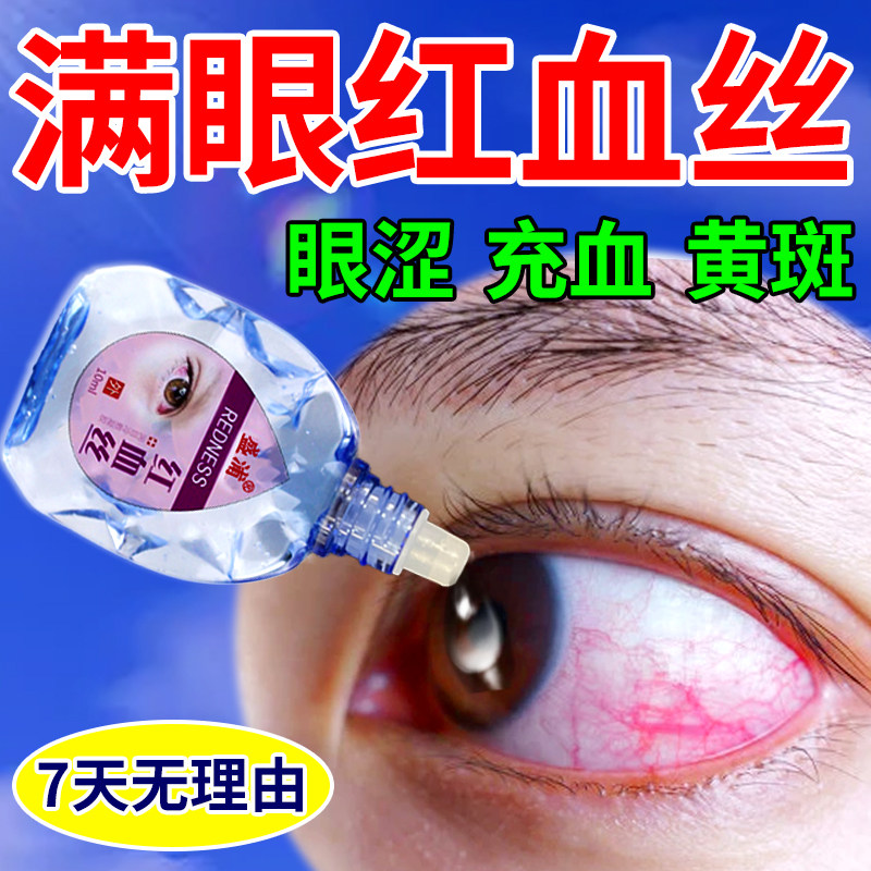 眼药水去红血丝抗疲劳缓解眼底出血消除眼睛有干涩发痒眼痒滴眼液